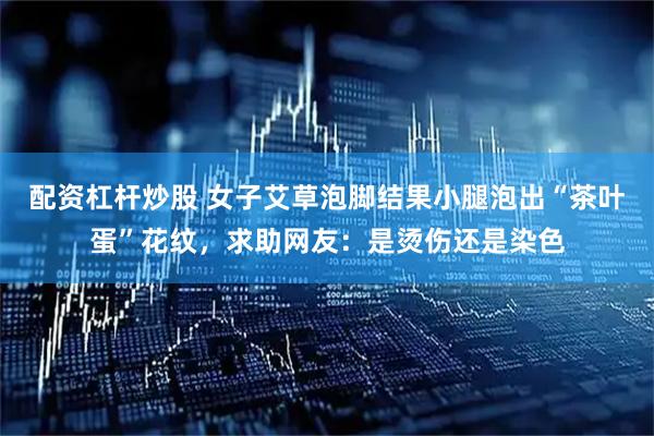 配资杠杆炒股 女子艾草泡脚结果小腿泡出“茶叶蛋”花纹，求助网友：是烫伤还是染色